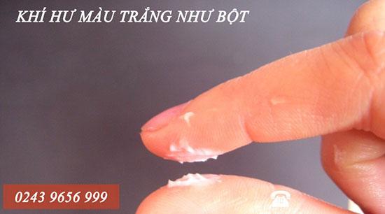 Vùng Kín Ra Chất Bột Màu Trắng